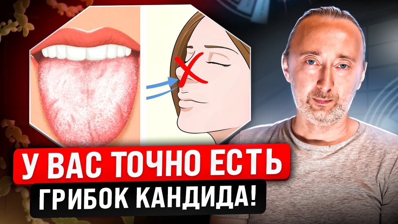 КАНДИДА: ЭТО избавит от молочницы и других грибков - паразитов НАВСЕГДА ...