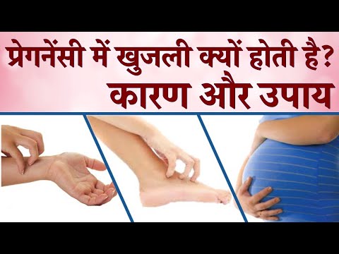 प्रेग्नेंसी में मैं खुशी क्यों होती है और ऊपर | गर्भावस्था के दौरान खुजली की समस्या हिंदी में