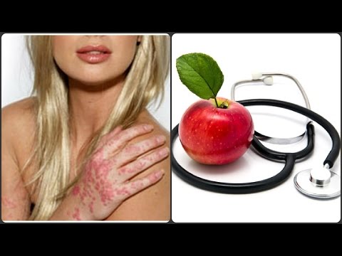 וִידֵאוֹ: 4 דרכים לטיפול בעור יבש