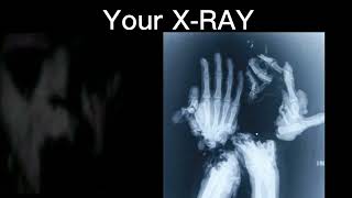 Mr.Incredible Becoming Uncanny(Your X-RAY)