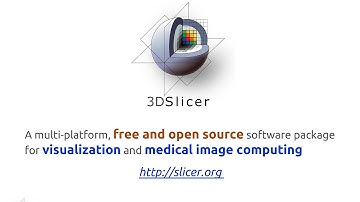 3D Slicer teaser video