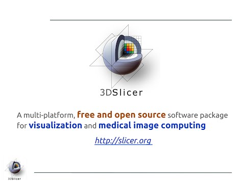 3D Slicer image computing platform