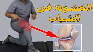 الخشونه فى الشباب الاسباب والعلاج/هل الخشونه مرض كبار السن فقط ؟/خشونة الركبه المبكره