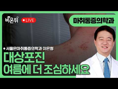대상포진, 여름에 더 조심하세요 / 서울은마취통증의학과 <strong>이은형</strong>