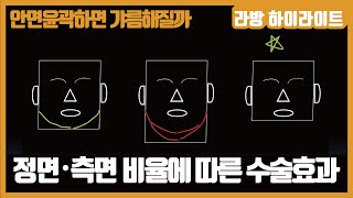 (SUB) 얼굴형, 비율에 따른 윤곽수술에 대해 [안면윤곽하면 갸름해질까 #1] 顔型、比率に応じた輪郭手術について［顔面輪郭手術をすれば細くなるか #１］