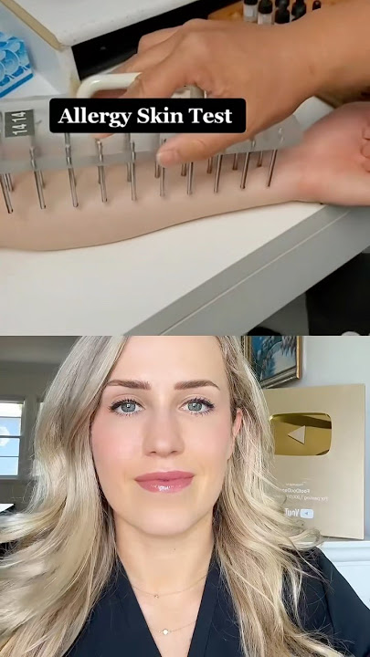 THIS is how allergy testing works