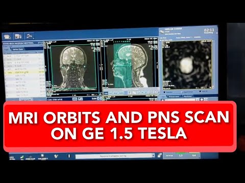 MRI Scan PNS - Orbits Technique Full Process on GE 1.5 TESLA, Live Demo.