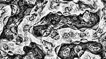 Scale-Deviation Pattern