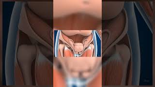 uterine prolapse problem in female #medical #animation #medicalanimation #health