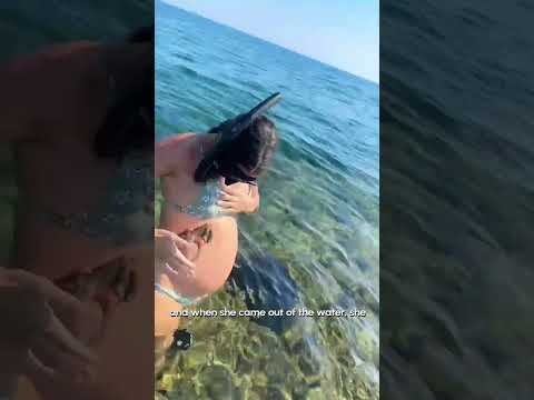 Baby Octopus Clings To Pregnant Woman S Belly