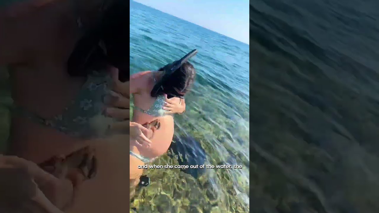 Baby Octopus Clings To Pregnant Woman S Belly