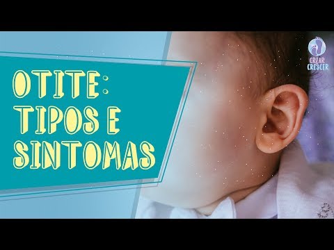 Vídeo: Sintomas De Otite Média Em Uma Criança
