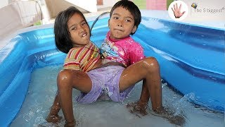 Conjoined Twins: Boy and Girl! Is it Possible? ~ Body Bizarre!