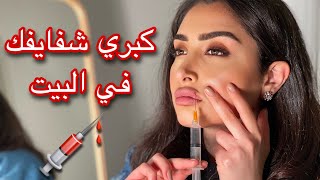 طريقة تكبير الشفايف في البيت 💉 | ما توقعت الموضوع بهالسهولة