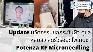 นวัตกรรมยกกระชับผิว ดูแลหลุมสิว ลดริ้วรอย: Potenza RF Microneedling โพเทนซ่า | หมอรุจชวนคุย