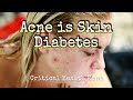 Acne is skin diabetes  pharmacist ben fuchs  moment of truth