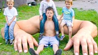 12 People With Bigger Than Normal Body Parts