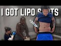 I GOT LIPO SHOTS...and this is WHAT HAPPEN😰😰 😩😩 | VLOGMAS DAY 4 |
