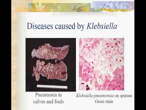 klebsiella pneumoniae gram stain