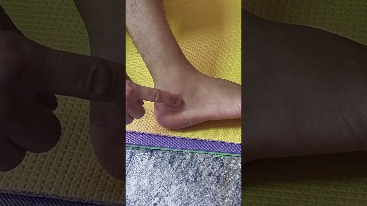 Нега чиққан ОЁҚни рентген курсатмайди