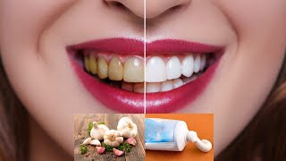 Get Whiter Teeth in 2 Minutes with This DIY Home Recipe for Yellow Stained Teeth