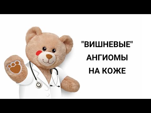 Видео: Являются ли вишневые ангиомы раковыми?