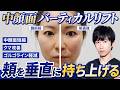 中顔面短縮は糸リフトでできる？バーティカルリフト施術と1週間後の変化を公開