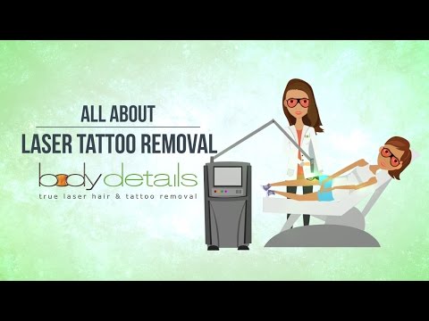 All About Laser Tattoo Removal | Body Details