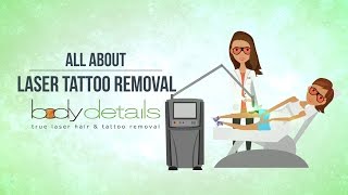 All About Laser Tattoo Removal | Body Details