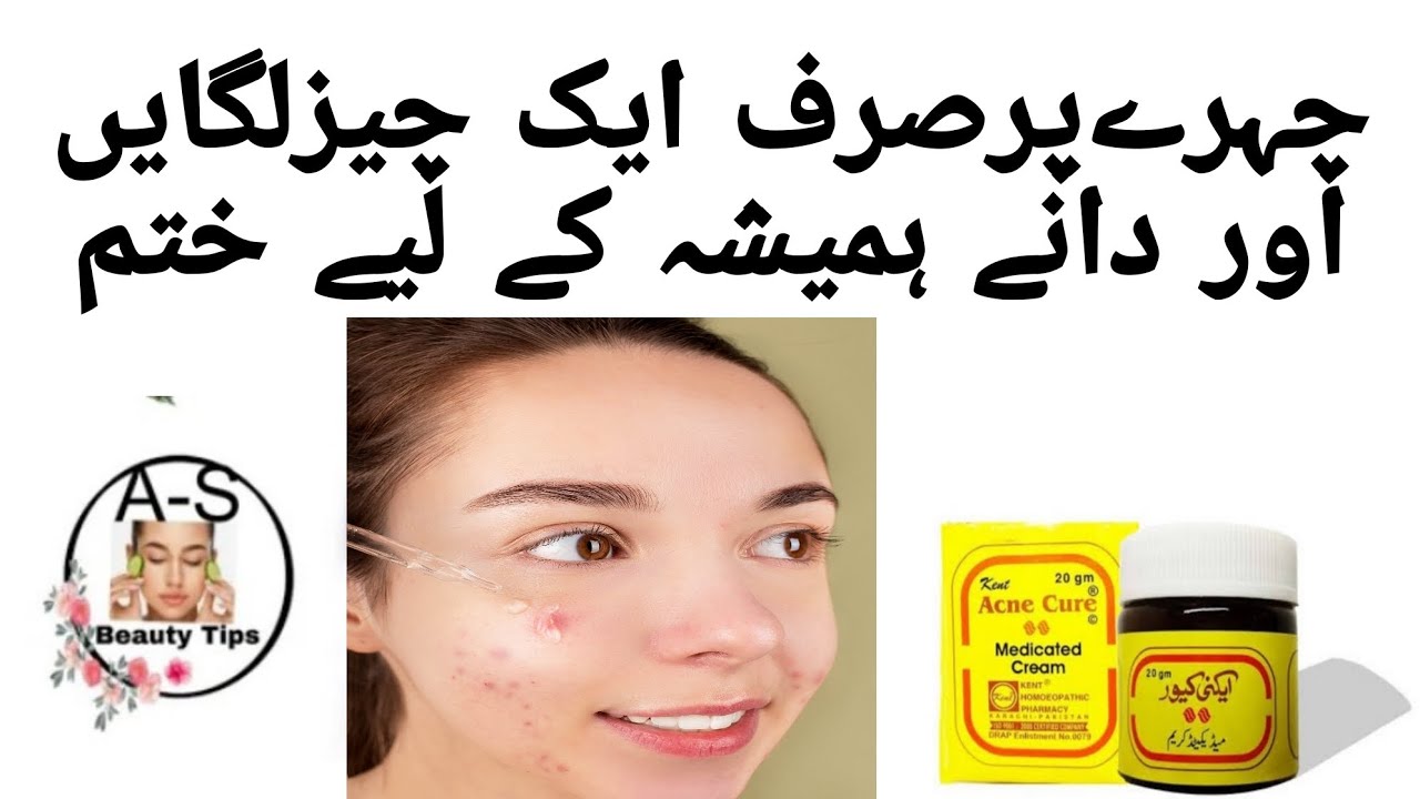 How To Remove Pimple Best Cream To Remove Pimple Permanently YouTube