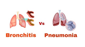 Understanding Bronchitis vs. Pneumonia: Key Differences and Symptoms Explained