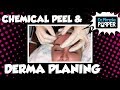 Esthetician Services: Jacki doing a chemical peel and derma planing