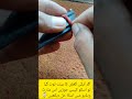 IMRAN TIME and VISION, Broken Watch Strap Ring? Quick Fix at Home! ⌚ #WatchStrapFix #shorts