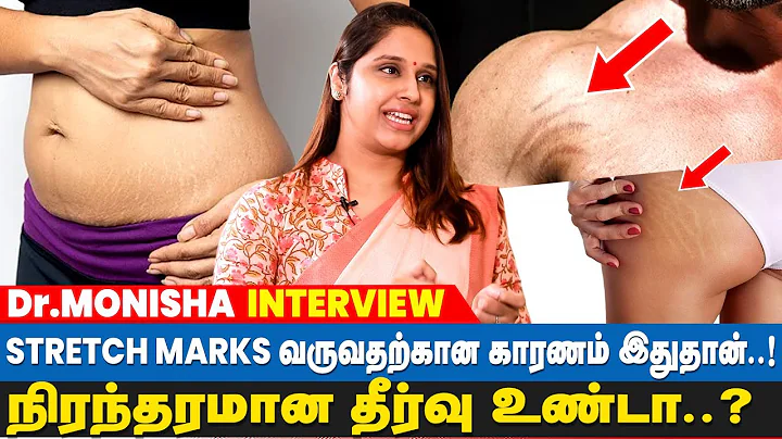 STRETCH MARKS  ! Dr.Monisha  | Dr Monisha Intervie...