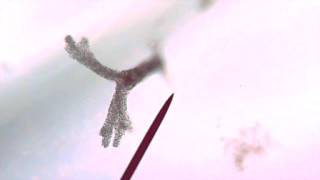 Amoeba proteus - Time lapse 8x
