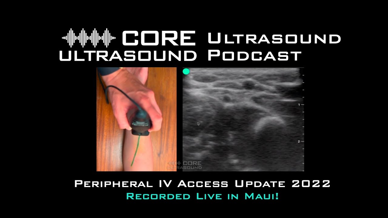 Peripheral Vascular Access Update 2022!