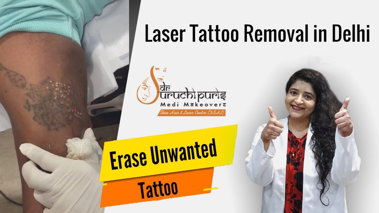 Infected Tattoo Stages: Signs of Infection from Tattoos and After Tattoo  Removal | Removery