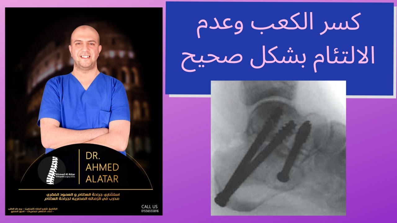 كسر الكعب - عدم الالتئام بشكل صحيح