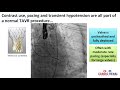 Renal Considerations in Transcatheter Aortic Valve Replacement: AKI, CKD, ESRD