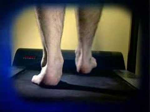 Dr. Douglas Cutter, from HCA Virginia Sports Medicine, discusses the importance of proper running fo. 