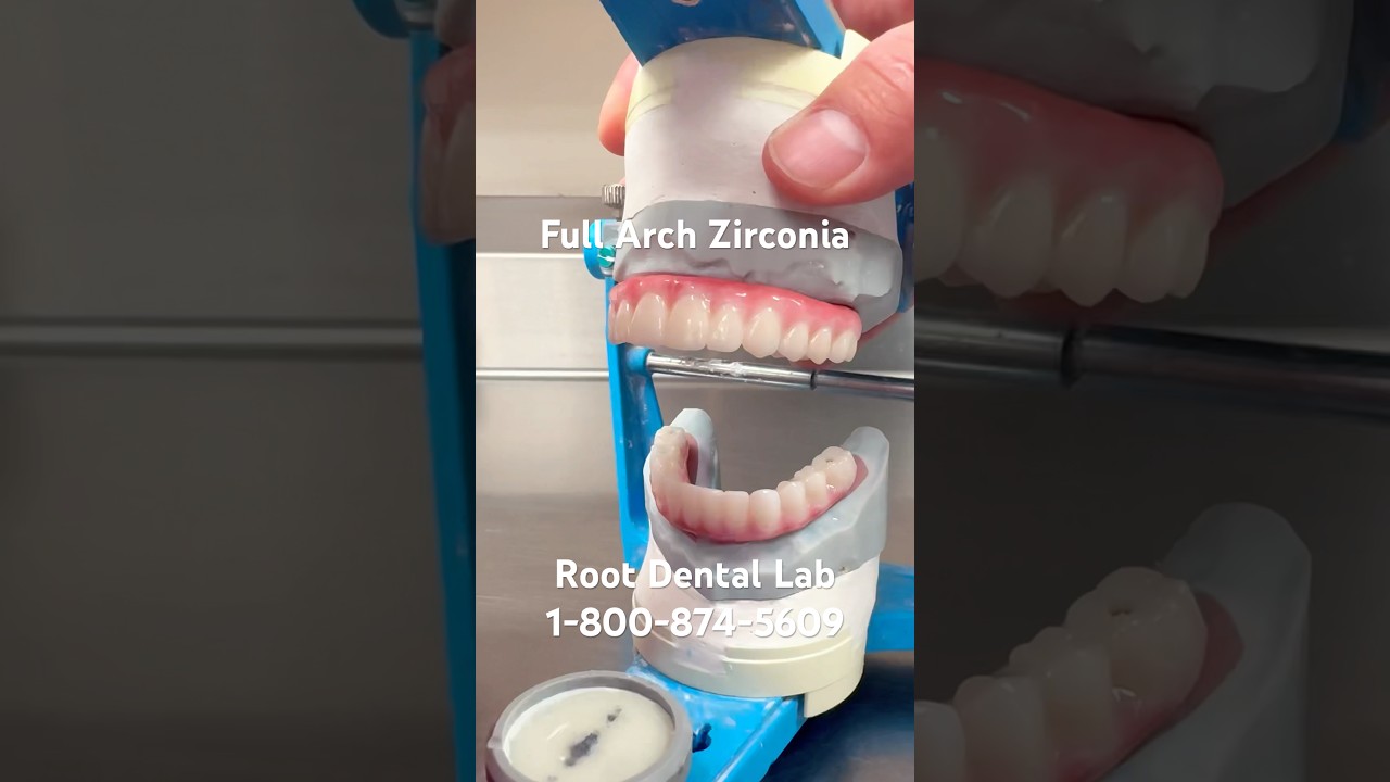 FULL Zirconia Arch with Astron Night Guard 