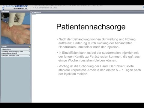 Vortrag und Live-OP: Handverjüngung durch Hyaluronsäure (Macrolane)