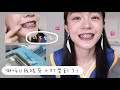 牙套日記EP2｜我拔牙＋打骨釘了🎉真的不會痛!!一樣可以自然大笑♡（上集）