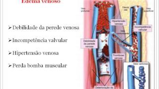 Periférico edema classificação do