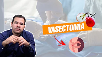 ¿Es indolora la vasectomía?