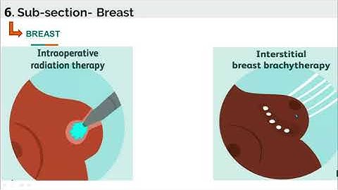 Integumentary system - Breast Introduction - Current Procedural Terminology