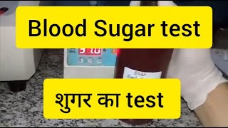 Bsf | Bspp | Rbs | Gct | Gtt | Sugar test | blood Sugar test | Normal blood Sugar level