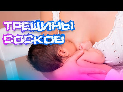 ТРЕЩИНЫ СОСКОВ: РАСКРЫВАЕМ ПРИЧИНЫ, ЛЕЧЕНИЕ и СЕКРЕТЫ ПРОФИЛАКТИКИ!