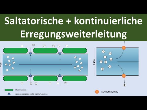Video: 3 Möglichkeiten, ein Fruchtwasserleck zu identifizieren