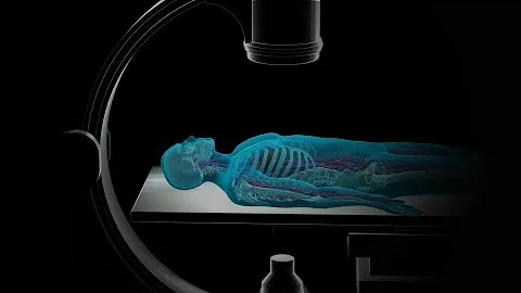 Come si fa un angiografia cerebrale?